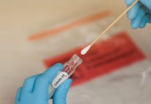 Pandemia/Ambasada turke jep njoftimin e rëndësishëm për shqiptarët