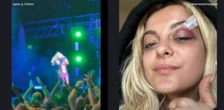 Bebe Rexha a fost lovită în față cu un telefon mobil în timpul concertului